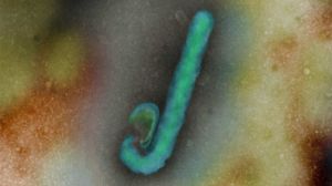 The Ebola virus causes diarrhoea and internal and external bleeding.