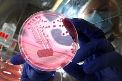Antibiotic resistant E. coli is causing major problems for medical researchers. Photo: Getty