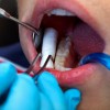 dental-check-up