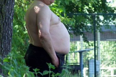 Obesity 
