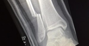 grohl's x-ray CHVdamUUAAA8RlS
