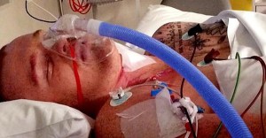 Alex McKinnon battled dark thoughts while hospitalised.
