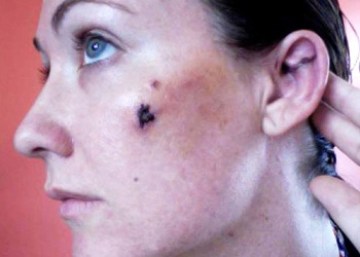 Kara Burn
