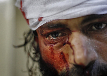 wounded syrian man