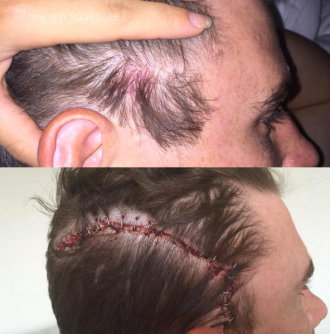 The Bachelorette star posted this grisly warning on Instagram. Photo: Instagram