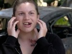 e-cigarette-injuries