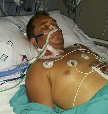 Mr Whitby was so close to death he had to accept a donated liver with Hepatitis B.