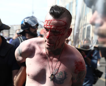 One supporter is left bloodied. Photo: Getty