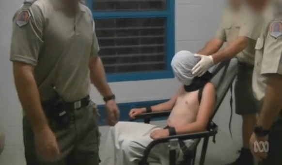 The 17-year-old was hooded, shackled to a "mechanical device" chair and left alone for two hours.