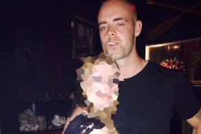 Mr Jackson has critical head injuries, with his father due to fly into Townsville on Thursday.