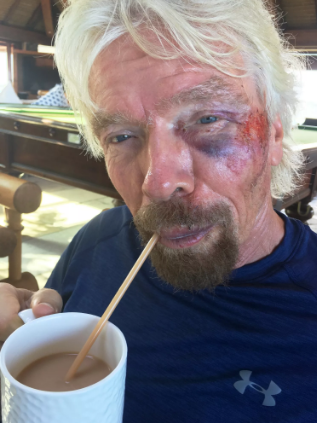 richard branson bike crash
