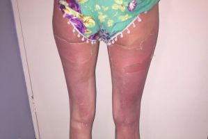 banana boat sunscreen