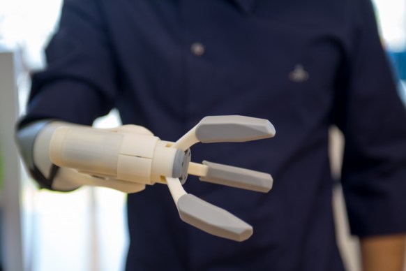 A 3D printed prosthetic arm that can be mass produced, designed by a Japanese company. Photo: Getty