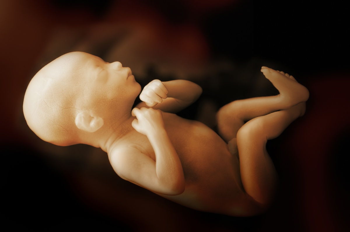 Pregnancy stillbirth unborn baby