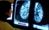 Mammogram