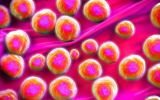 Superbug