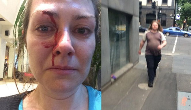 Melbourne woman Erica Moloney attacked.