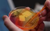 Modern life is reducing the range of microbes occupying the human anatomy.