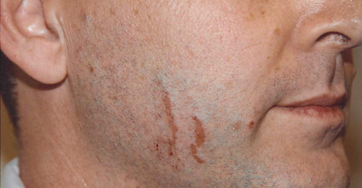 gerard baden-clay