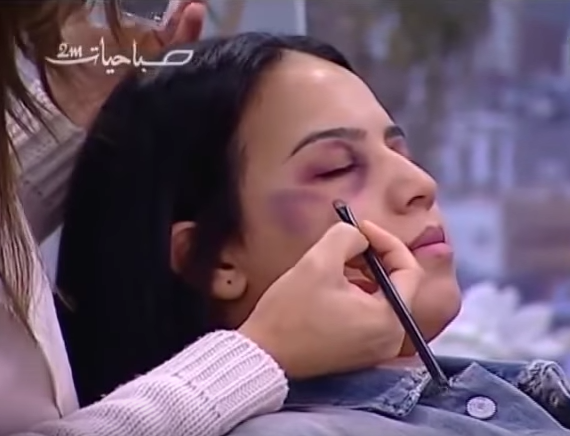 Make up to cover domestic violence