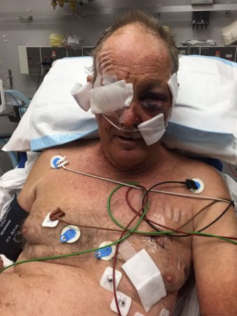 cyclist shot in head