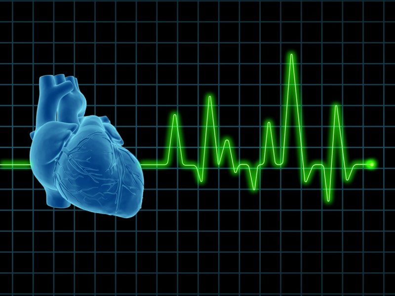Heart attack