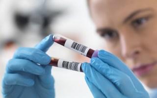 ovarian-cancer-test