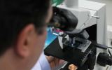 Ovarian cancer