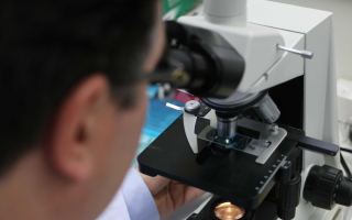 Ovarian cancer
