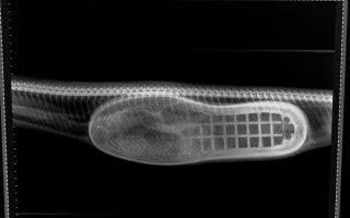 Snake x-ray