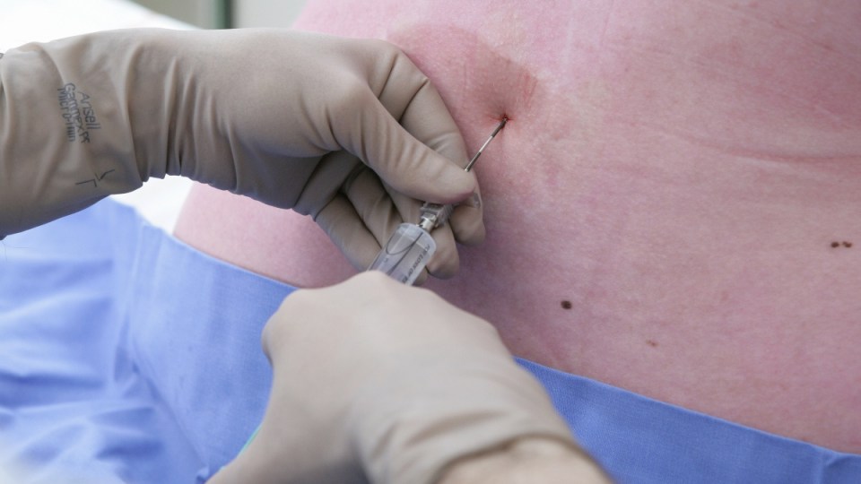 Epidural