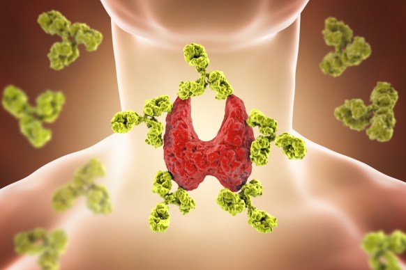 Hashimoto's disease