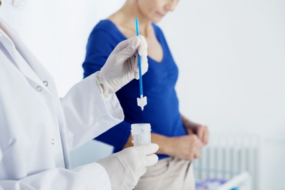 Cervical screening
