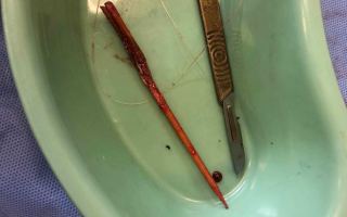 The daughters were taken overseas for genital mutilation surgery.