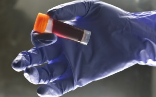 aids cure hope