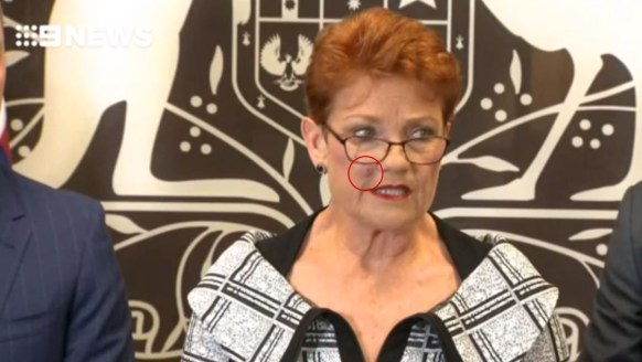 Pauline Hanson