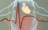illustration of obese man with heart disease