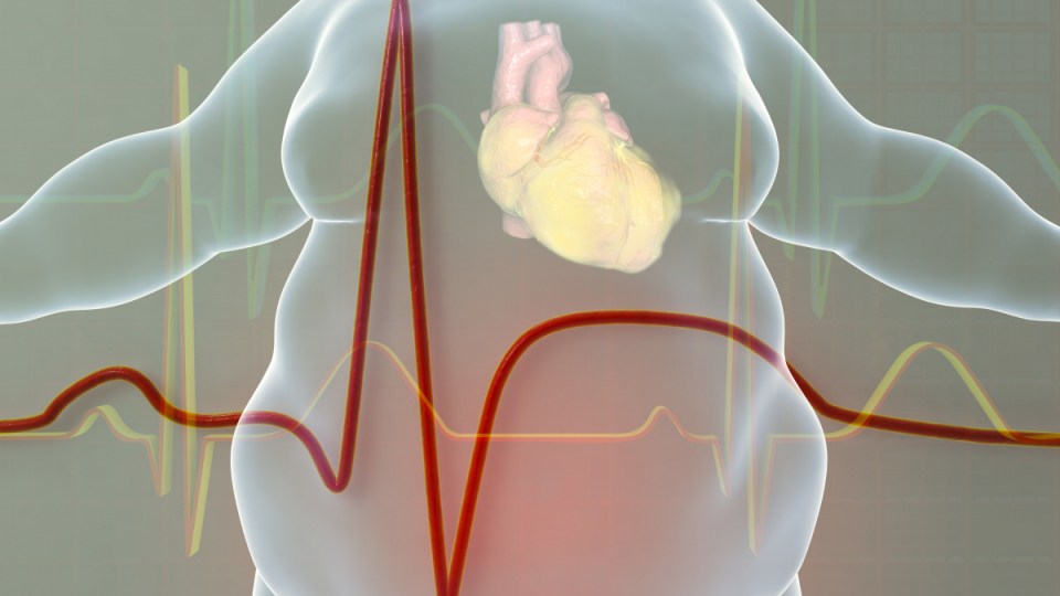 illustration of obese man with heart disease