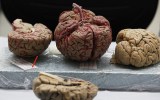 Parkinson's disease