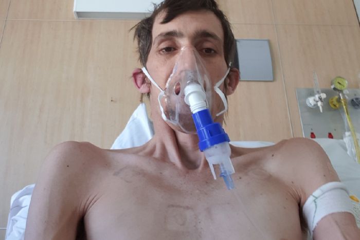 silicosis