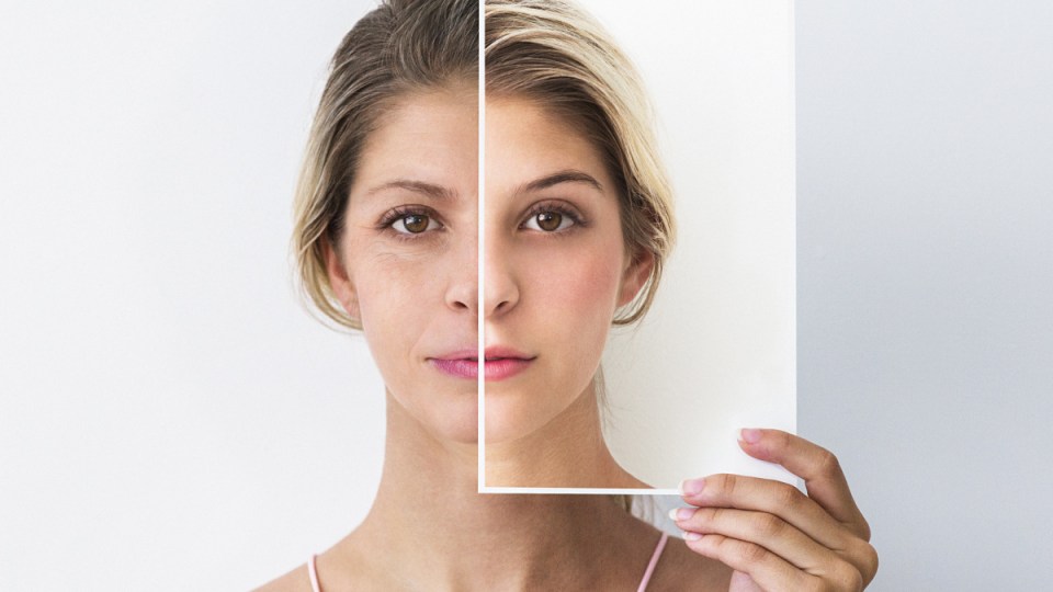 face lifts