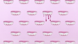 Bledding gums