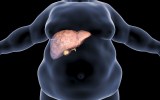 liver disease