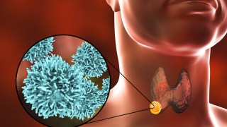 thyroid