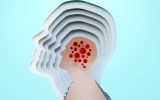 COVID-19 brain