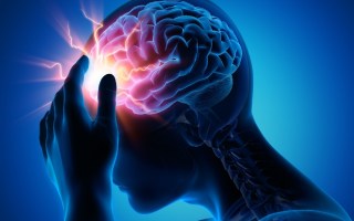 migraine