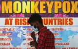 mpox