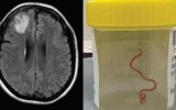 brain
