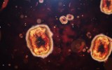 mpox