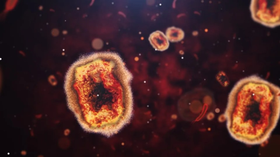 mpox